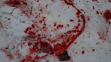 Неизвестные жестоко избили общественника Сергея Горра в Бийске