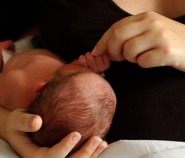 Затылок новорожденного. Кефалогематома у новорожденных. Венки на голове новорожденного.