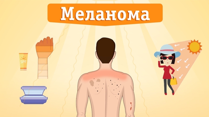 Иллюстрация: Amic.ru