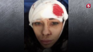 Активная мамочка ударила потерпевшую в лоб ножом / Фото: кадр из видео