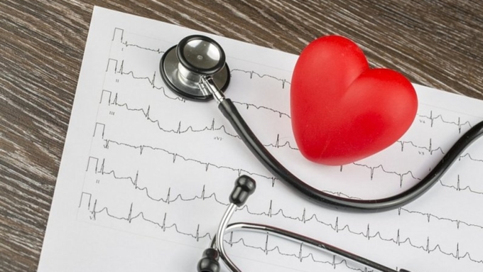 Треть смертей от инсультов вызваны сердечной аритмией / Фото: medaboutme.ru