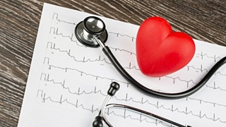 Треть смертей от инсультов вызваны сердечной аритмией / Фото: medaboutme.ru