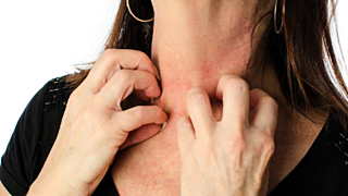 Пациентам с зудом рак диагностировали в шесть раз чаще / Фото: vzboltay.com