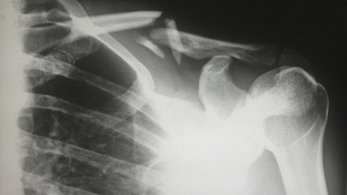 Фото: unsplash.com