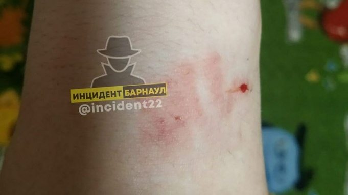 Фото: "Инцидент Барнаул"