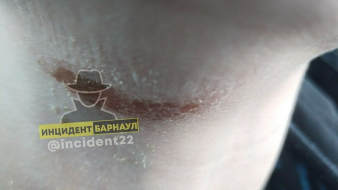 Фото: "Инцидент Барнаул"