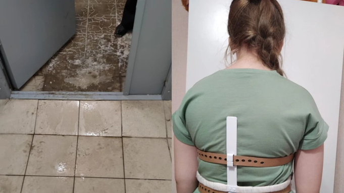 Пострадавшая школьница / Фото матери пострадавшей / "КП-Новосибирск"