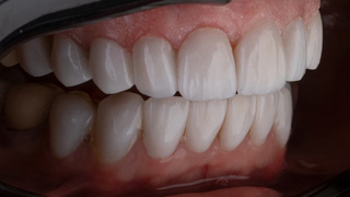 Человеческие зубы / Фото: unsplash.com