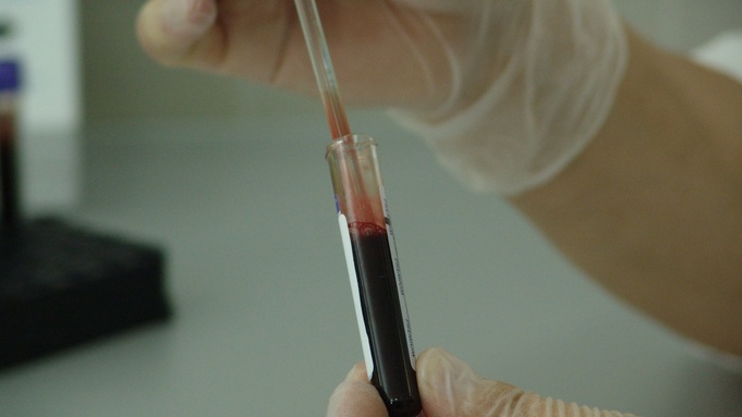 Пробирка с кровью / Фото: pxhere.com