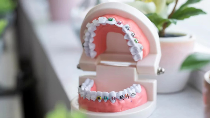 Челюсть человека / Фото: unsplash.com