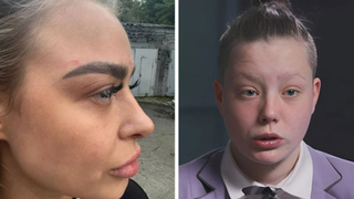 Пострадавшие девушки / Фото: "КП-Новосибирск"