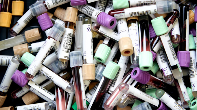 Пробирки / Фото: unsplash.com / Testalize.me