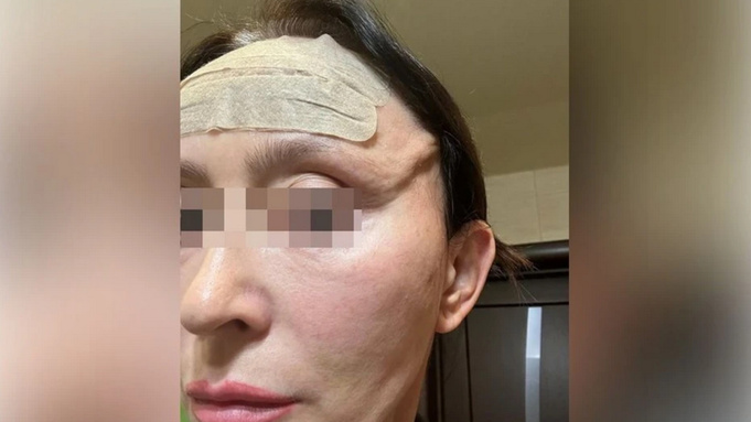 Последствия операции / Фото: предоставлено героиней материала "КП-Новосибирск"