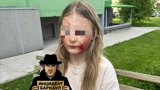 Пострадавшая девочка / Фото: "Инцидент Барнаул"