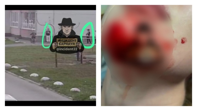 Мальчик порезал девочке лицо / Кадр из видео: "Инцидент Барнаул"
