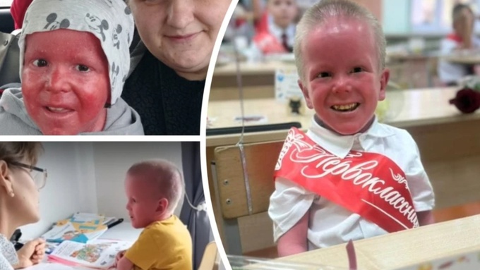 Мальчик-рыбка из Новосибирска / Фото предоставлено для "КП-Новосибирск" семьей Переходченко, телеграм-канал «Семья для Никиты»