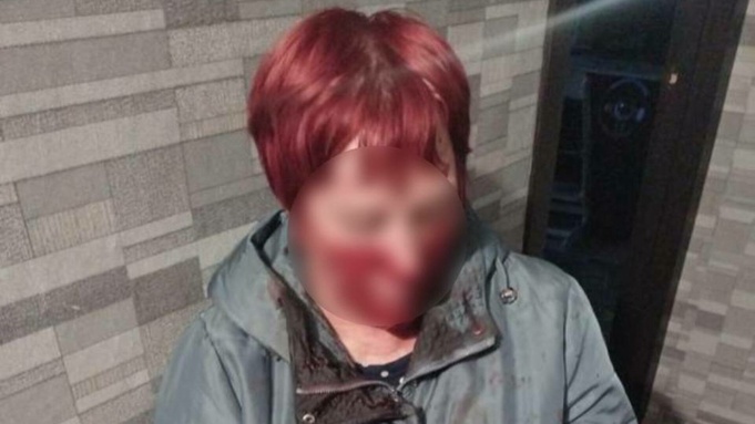 Женщину избили в Новоалтайске / Фото: "В курсе 22"