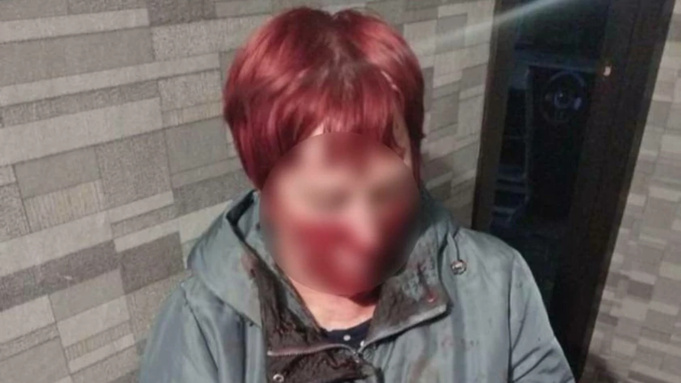 Женщину избили в Новоалтайске / Фото: "В курсе 22"