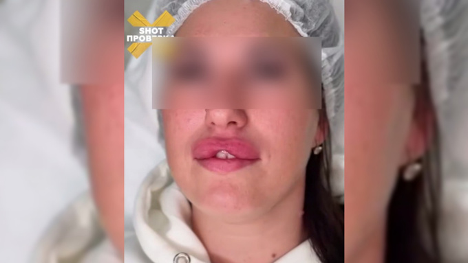 Методика "заячьих губок" / Кадр из видео: "Shot Проверка"