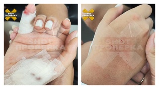 Последствия нападения акулы / Фото: "Shot Проверка"