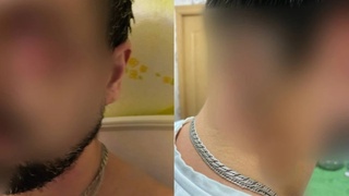 Хозяин бойцовской собаки натравил ее на прохожего / Фото: "КП-Новосибирск"