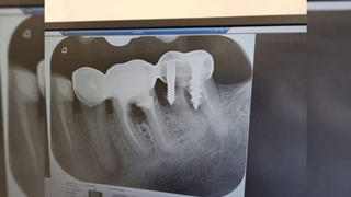 Рентгеновский снимок полости рта / Фото: "Молния. Москва"