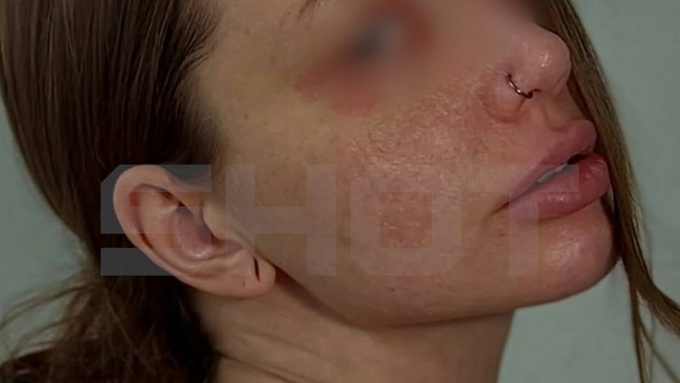 Пострадавшая девушка /Фото: @shot_shot