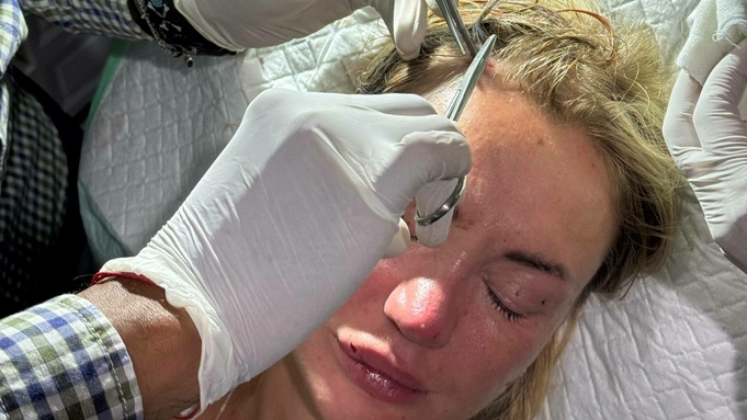 Голову зашивали на месте / Фото из Telegram-канала Карины Фадеевой