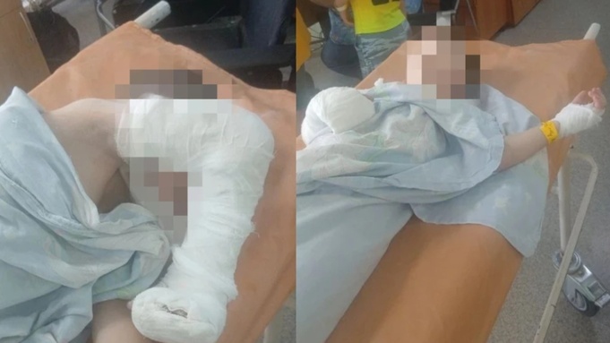 Мальчик до сих пор восстанавливается / Фото: "КП-Новосибирск"