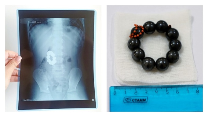 Магниты / Фото: Детская клиническая больница № 7