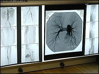    Открытие клинической больницы