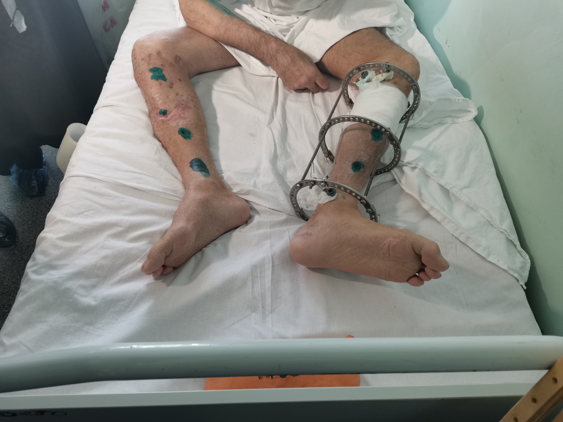 Владимир больше 250 дней находится в больнице / Фото: amic.ru